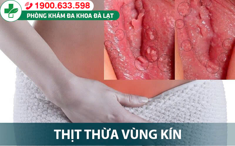 Block Image